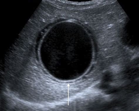 Sonography, Pathology, Diagnosis, Medicine, Liver, Registry, Echo ...