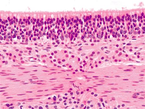 Olfactory Epithelium