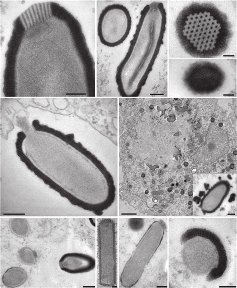 Electron microscopy imaging of the Pithovirus replication cycle in A ...