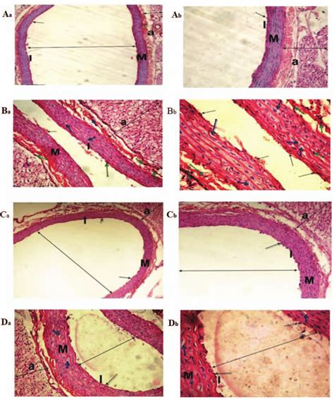 Light micrographs of the dorsal aorta. The (Aa and Ab) control and (Ca ...