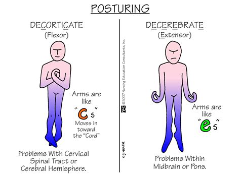 Nursing School: Medical Surgical Nursing Mnemonics