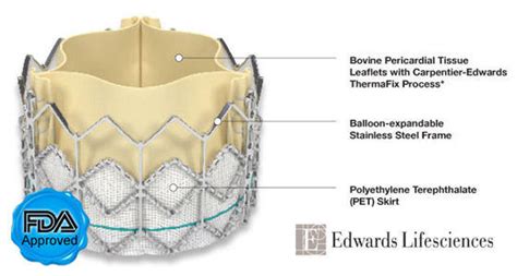 FDA Approval -- SAPIEN Transcatheter Aortic Valve