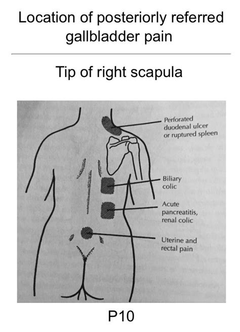 Gallbladder Pain Location Diagram