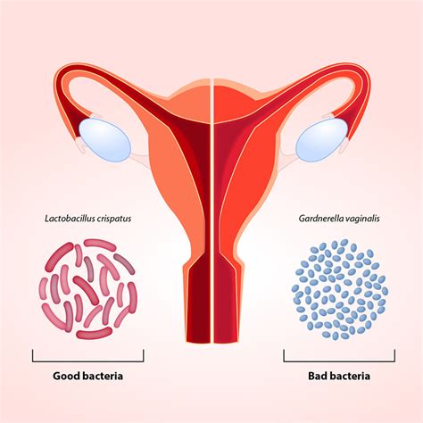 The vaginal microbiota, what it is and why it is important