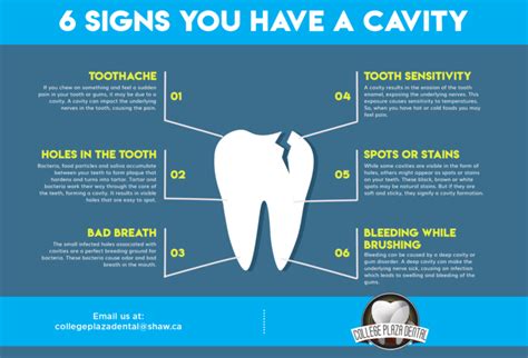 6 Signs You Have A Cavity - College Plaza Dental Associates