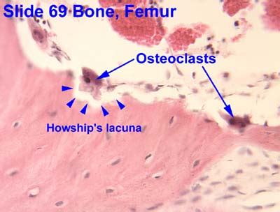 normal bone histology