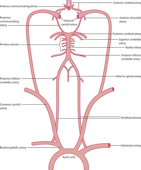 Posterior circulation ischaemic stroke and transient ischaemic attack ...