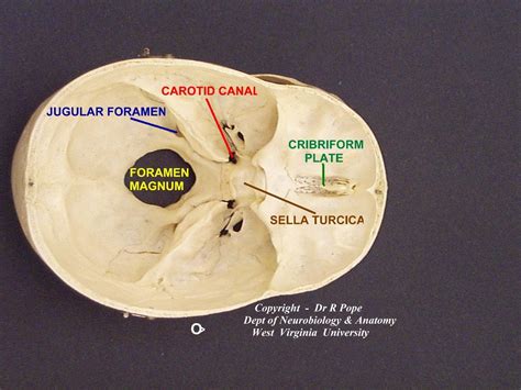 Miscellaneous (Jugular Foramen.)