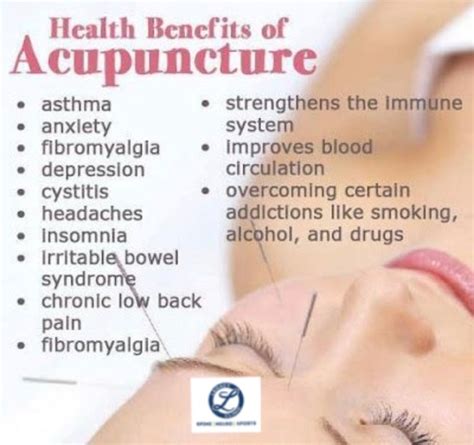 What Is Acupuncture - Benefits - Legacy Clinic Chiropractic