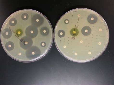 crazybiocomputing: Analysis of an Antibiogram