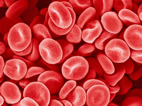 An elevated platelet count, thrombocytosis, is defined as a platelet ...