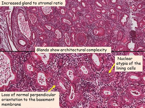 Endometrial Gland Histology