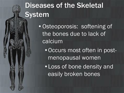 diseases that effect skeletal anatomy