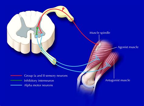 Spasticity : Cause, Symptom's, Physio Treatment, Exercises