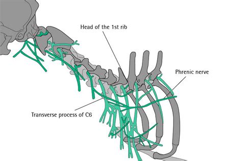 Canine Brachial Plexus