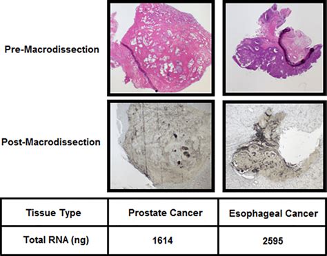 RNA extraction from FFPE tumor tissues - Integrated Laboratory Systems