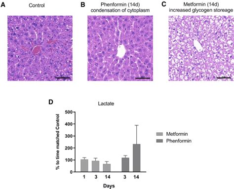 Liver changes after metformin and phenformin treatment. a–c ...