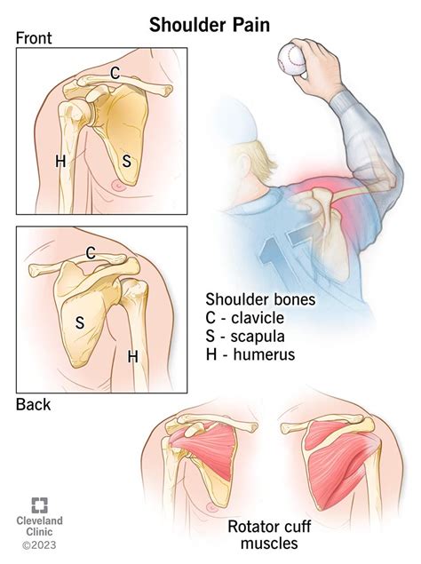 Shoulder Joint Pain Causes Treatment Chris Homan, 51% OFF