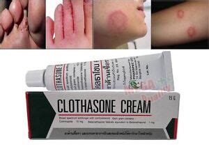 CLOTHASONE CREAM Antifungal Corticosteroid for Tinea Ringworm Athlete ...