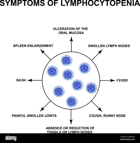 Symptoms of lymphocytopenia. Decreased lymphocytes in the blood ...