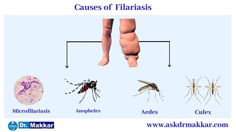 Elephantiasis Symptoms