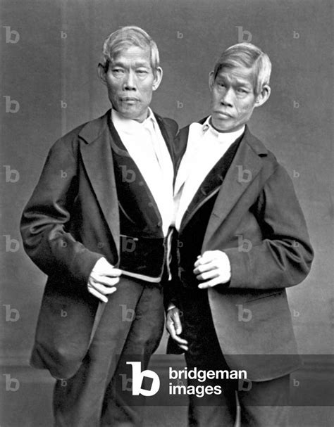 Image of Thailand / USA: Chang and Eng Bunker, the original conjoined