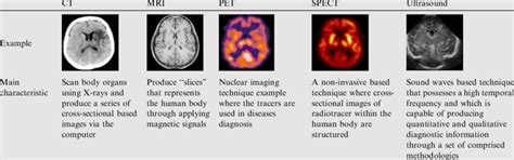 A comparison of major diagnostic radiology images. | Download Table