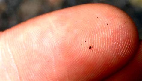 How To Steer Clear Of Chiggers And Enjoy The Outdoors - Off The Grid News