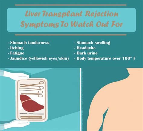 Liver Transplant Rejection Symptoms - Fatty Liver Disease