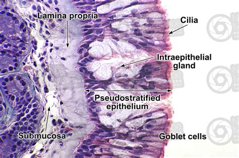 Man. Nasal mucous membrane. Vertical section. 500X - Man - Mammals ...