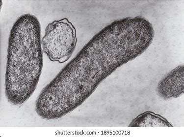 Bacterial Cell Under Microscope Labeled