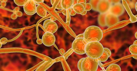 Candida auris fungal infection: What is it and who is at risk ...