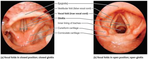 Epiglottis anatomy, location, function and epiglottis infection