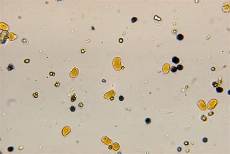 Endolimax Nana Trophozoite