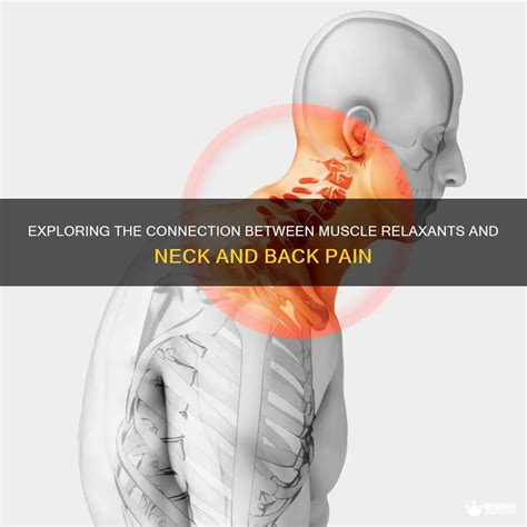 Exploring The Connection Between Muscle Relaxants And Neck And Back ...