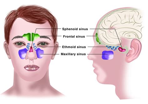 Chronische Sinusitis | Galenushealthcompass