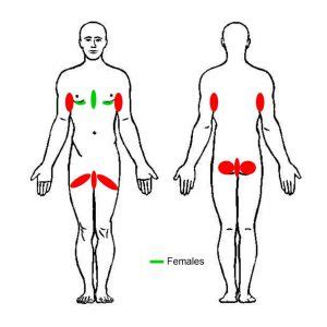 Hidradenitis Suppurativa – EHSF e.V.