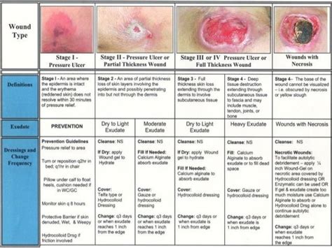 Pressure ulcer, Wound care nursing, Wound care