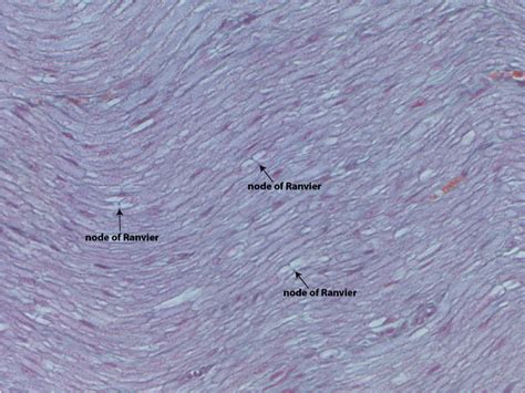 Motor Neuron Slide Labeled Glial Cells