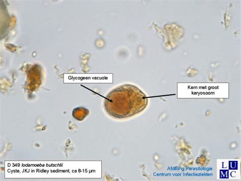 Iodamoeba bütschlii | Medical Laboratories