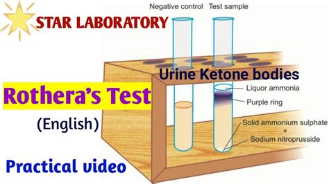 😝 Rothera test for ketone bodies. Rothera's test Principle, Procedure ...