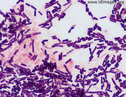 Bacillus Images - Infectious Disease Images - eMicrobes Digital Library ...