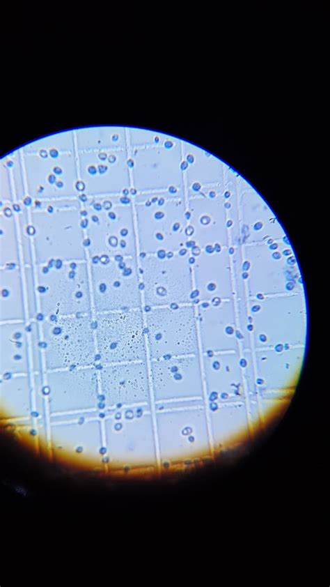 Methylene Blue Staining