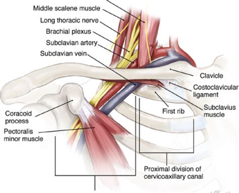 Thoracic Outlet Syndrome Treatment - canvas-oatmeal