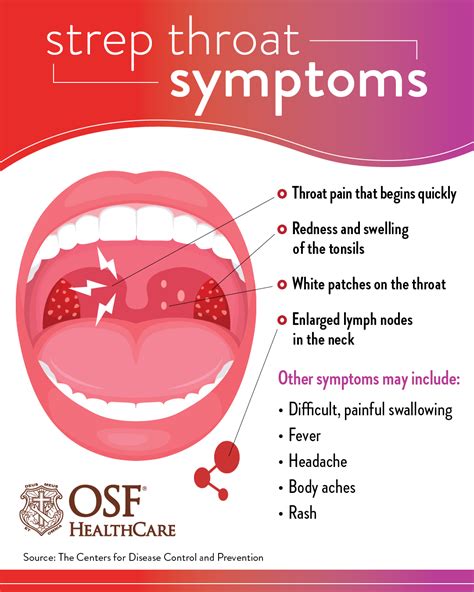 Strep Throat Signs Symptoms And Complications | Hot Sex Picture