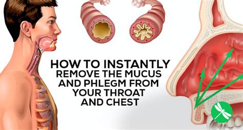 How to Eliminate Mucus and Phlegm From Your Throat and Chest ...