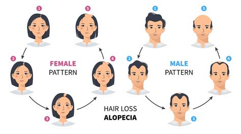 Medical Causes of Hair Loss: Who to See and What to Do