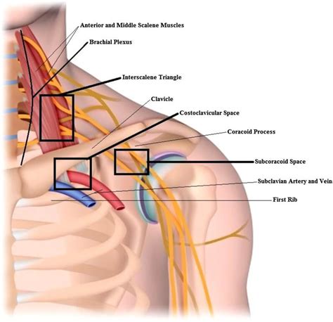 Thoracic Outlet Syndrome Exercises Stretches