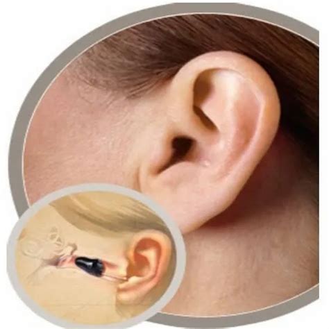 Iic Hearing Aids at Rs 25000 | Hearing Aids in Hyderabad | ID: 16029587748