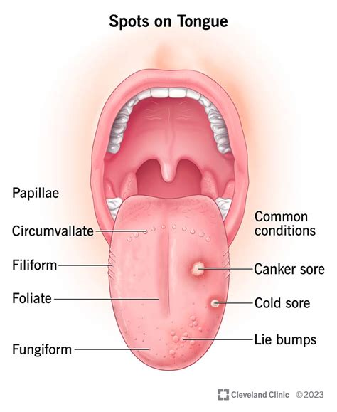 What Those Spots on Your Tongue Mean